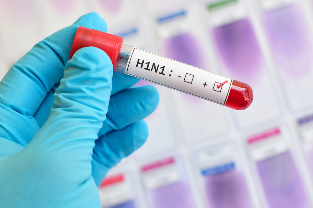 A laboratory sample for epidemic research